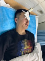 验房师武汉验房后遭人殴打 警方：涉案3人已被拘留