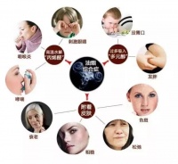 厨房油烟危害不可轻视，索奇L310为您打造无烟厨房！