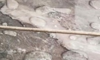头疼!美缝又“白白”了!